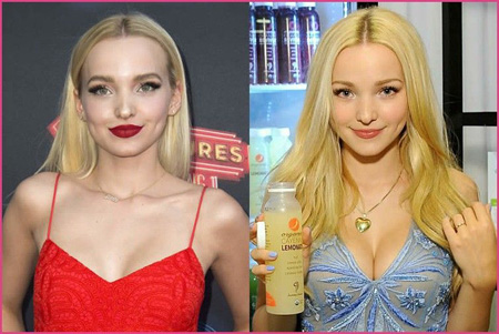 Dove Cameron's boob job seems to be real, but you decide.